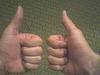 Two Thumbs Up!